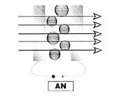 Galeriebild des Projekts Dreierwette