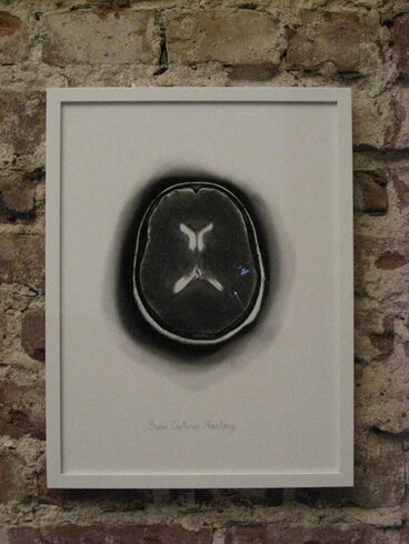 Brain Captures Phantasy Titelbild des Projekts Brain Captures Phantasy