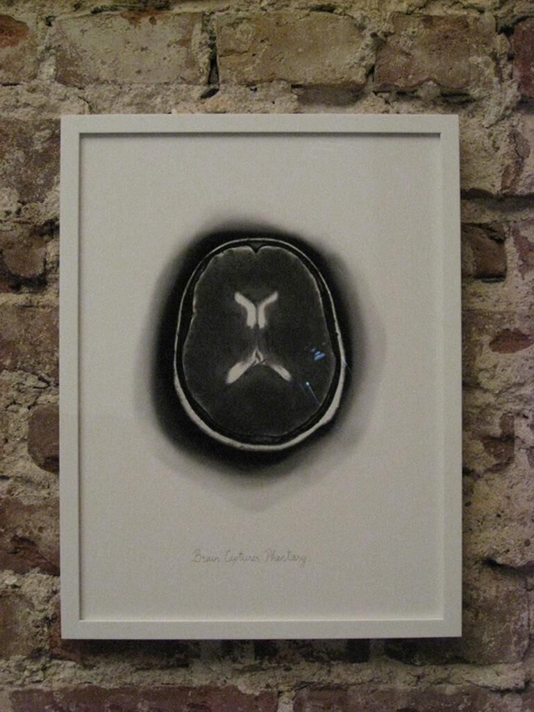 Titelbild des Projekts Brain Captures Phantasy