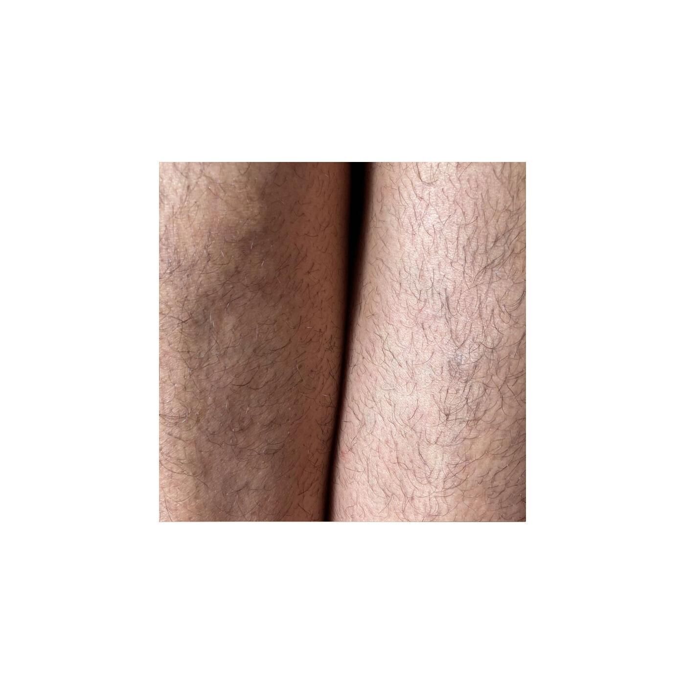 Galeriebild des Projekts W-haarnsinnig haarig 