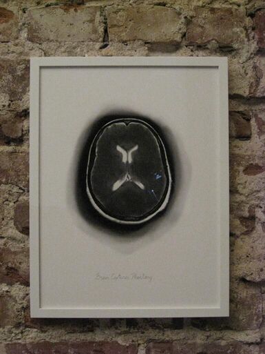 Titelbild des Projekts Brain Captures Phantasy