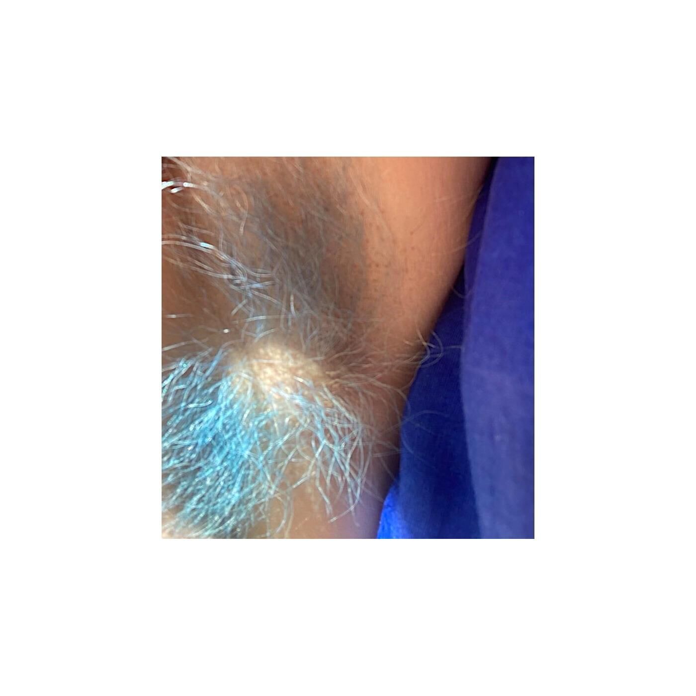 Titelbild des Projekts W-haarnsinnig haarig 