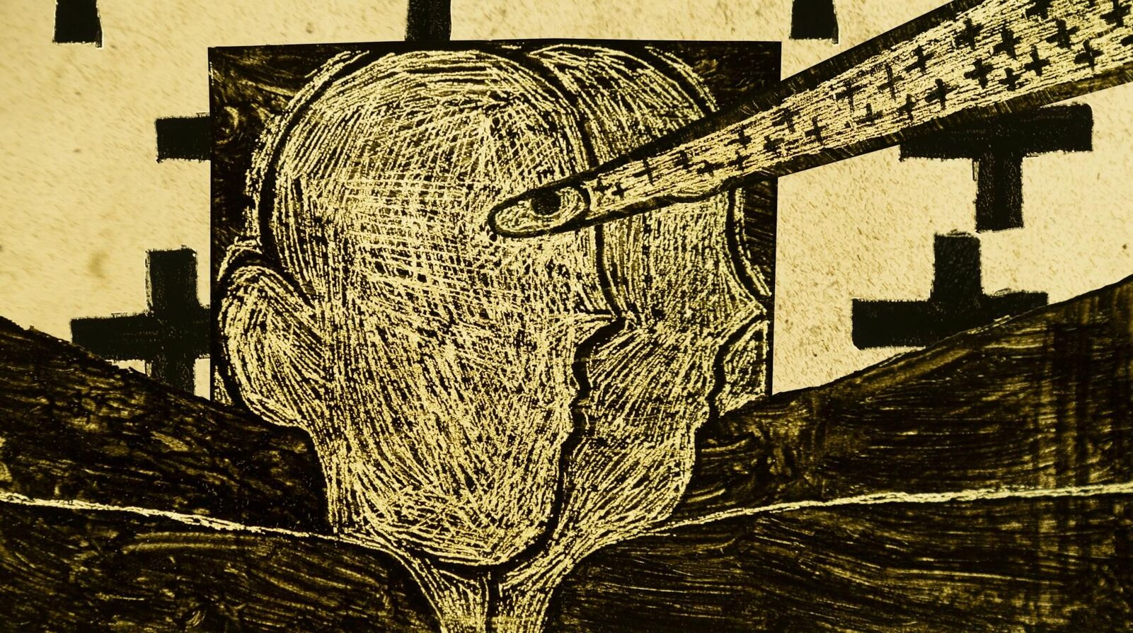 Galeriebild des Projekts Acupuncture