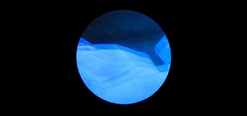Galeriebild des Projekts 70.7 Blau