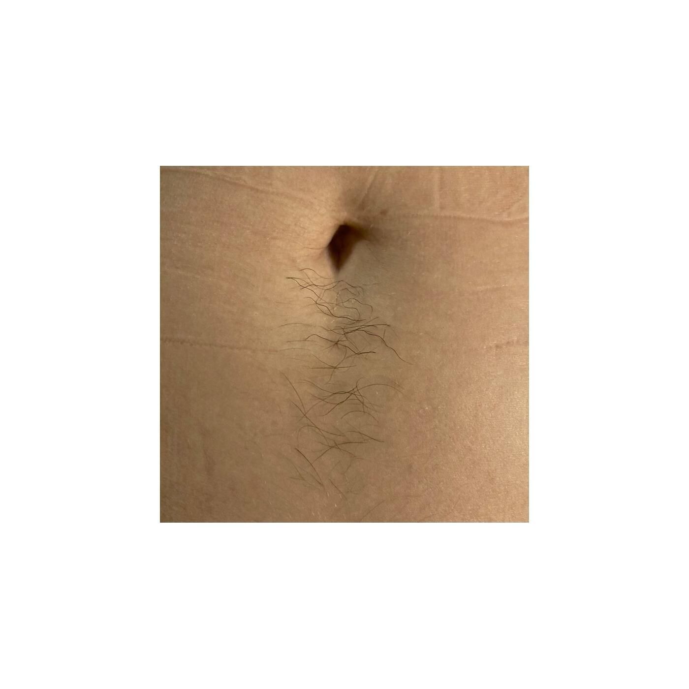 Galeriebild des Projekts W-haarnsinnig haarig 