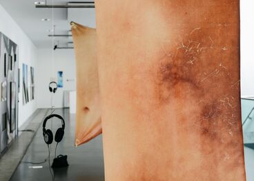 Galeriebild des Projekts Do you wanna hear about the tear in my body?