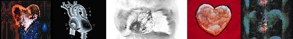 Titelbild des Projekts Nothing Broke but the Heart 